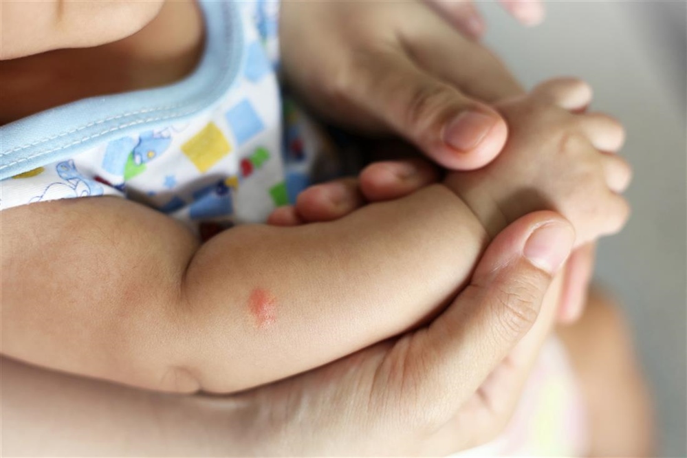 Kako zaštititi djecu od komaraca? Donosimo savjete dermatologa i prirodna rješenja