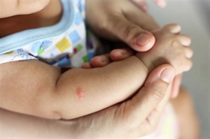 Kako zaštititi djecu od komaraca? Donosimo savjete dermatologa i prirodna rješenja