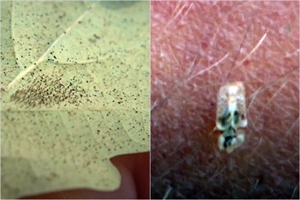 U kuću su vam došle stjenice, napasti kojih se teško riješiti i koje vas grizu – ovo morate odmah učiniti