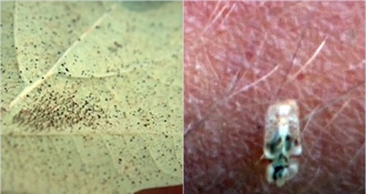 U kuću su vam došle stjenice, napasti kojih se teško riješiti i koje vas grizu – ovo morate odmah učiniti